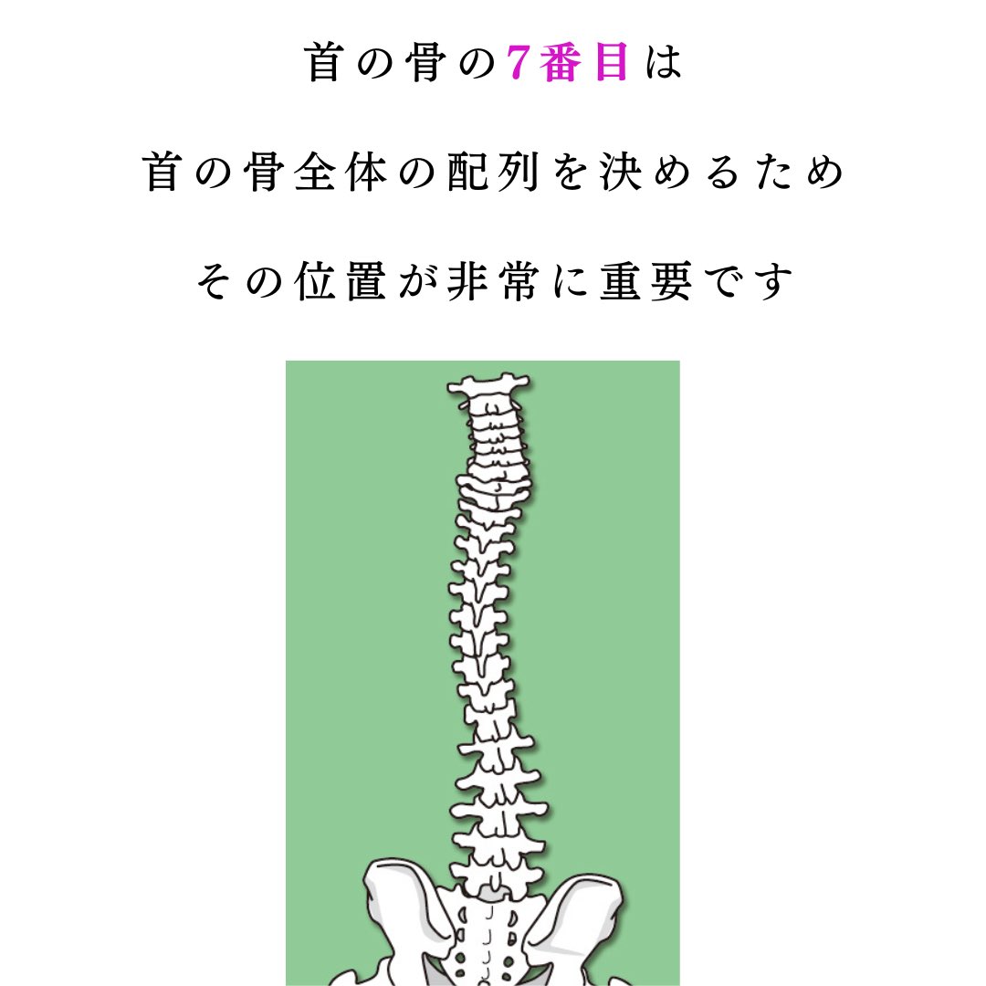 takasuzuki1123's tweet photo. 首周囲は神経や血管といった生命に重要なコードが密集しており、首の配列のズレが大きくなると色々な問題を起こすかもしれない。頚椎7番は首全体の配置・配列を左右する重要な骨。
筋肉においても過緊張や弱化が左右不均衡に起こることで首肩に不快な感覚が出ることもある。 https://t.co/s845LhKWMw