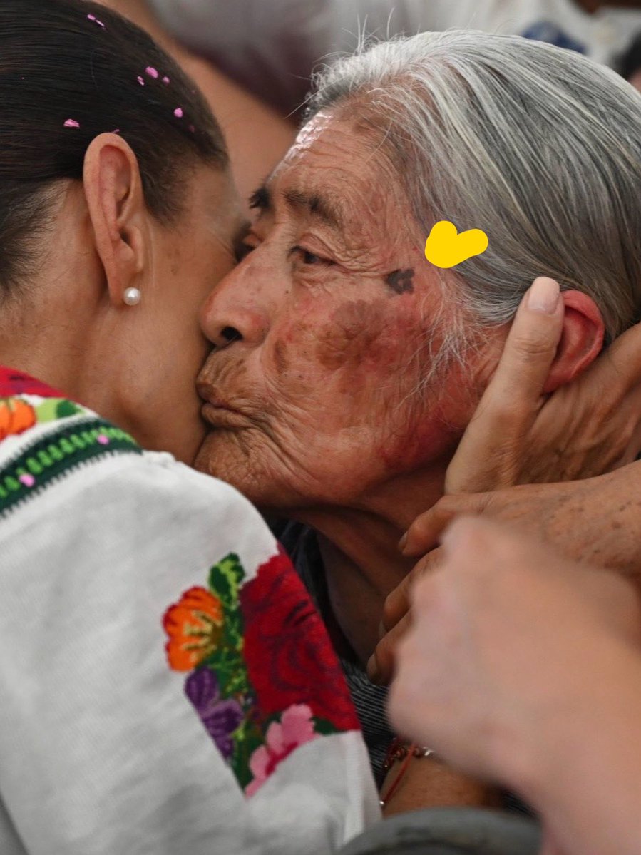 MarcelaSaebL's tweet photo. A esta mujer que besas, ojalá le puedas ofrecer un adecuado sistema de salud para resolver su melanoma lentigo maligno.  

#dermatopatología🔬💕 https://t.co/foUGSWrAR8