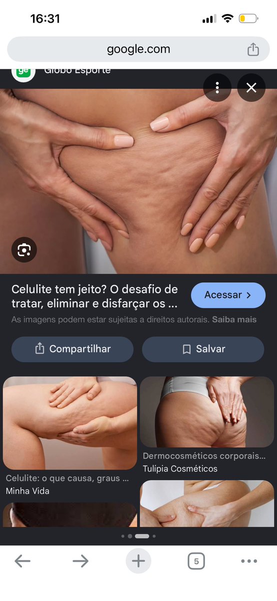 lysankcal's tweet photo. @furitilla essas “bolinhas”

nodulos tem textura bem diferente https://t.co/kzq9Sfcvp7
