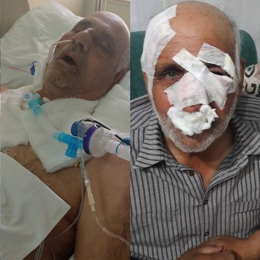 insanhaklarim's tweet photo. 72 yaşındaki Mustafa Topal, Gaziantep Nurdağı'nda başıboş köpeklerin saldırısına uğradı. Tam 54 gün yaşam mücadelesi verdi ve 2 Temmuz 2022 aramızdan ayrılmıştı.

Bir insanın kendi mahallesinde, kendi sokağında parçalanarak ölüme sürüklenmesi "münferit olay" değildir. Bu, yıllardır görmezden gelinen ve ideolojik tartışmalar uğruna çözümsüz bırakılan bir kamu güvenliği ve insan hakları meselesidir.

İnsan hayatını savunmak, hayvan düşmanlığı değildir. Bir çocuğun, bir yaşlının, bir kadının can güvenliğini istemek vicdansızlık değil, en temel insan hakkını savunmaktır.

Ne yazık ki her saldırının ardından aynı cümleleri duyuyoruz: "Üzgünüz, gerekli inceleme başlatıldı." Peki kaç can daha kaybedilecek? Kaç aile daha ocağına ateş düştükten sonra tedbir alınacak?

Devletin birinci görevi vatandaşının canını korumaktır. Sokaklar başıboş köpek sürülerine değil, vatandaşlara aittir. İnsanların korkuyla yaşadığı, çocukların parka gidemediği, yaşlıların akşam evinden çıkamadığı bir düzen kabul edilemez.

Mustafa Topal'ın vefatı, ihmallerin ve yıllardır ertelenen çözümlerin acı bir sonucudur. Bu ülkede insan hayatı, ideolojik sloganlardan ve popülist yaklaşımlardan daha değersiz değildir.

Mustafa Topal'a Allah'tan rahmet, ailesine sabır diliyorum. Dileğimiz odur ki onun adı, yeni acıların değil, insanın yaşam hakkını esas alan kararlı politikaların başlangıcı olsun.

Çünkü bir tek insanın bile göz göre göre hayatını kaybetmesi, hepimiz için bir insan hakları ihlalidir.

#BaşıboşKöpekSorunu
#StrayDogProblem 
@TC_icisleri 
@TCTarim 

https://t.co/eNkGubKdLU