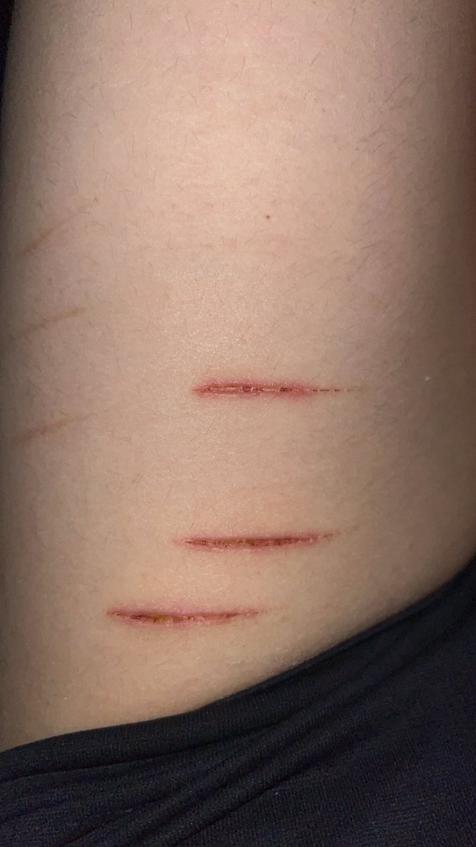 bartylusoffs's tweet photo. Do these look okay? They started turning a bit red around so idk… 4 days old btw (deleting this later) https://t.co/1A8SrZQ9gL