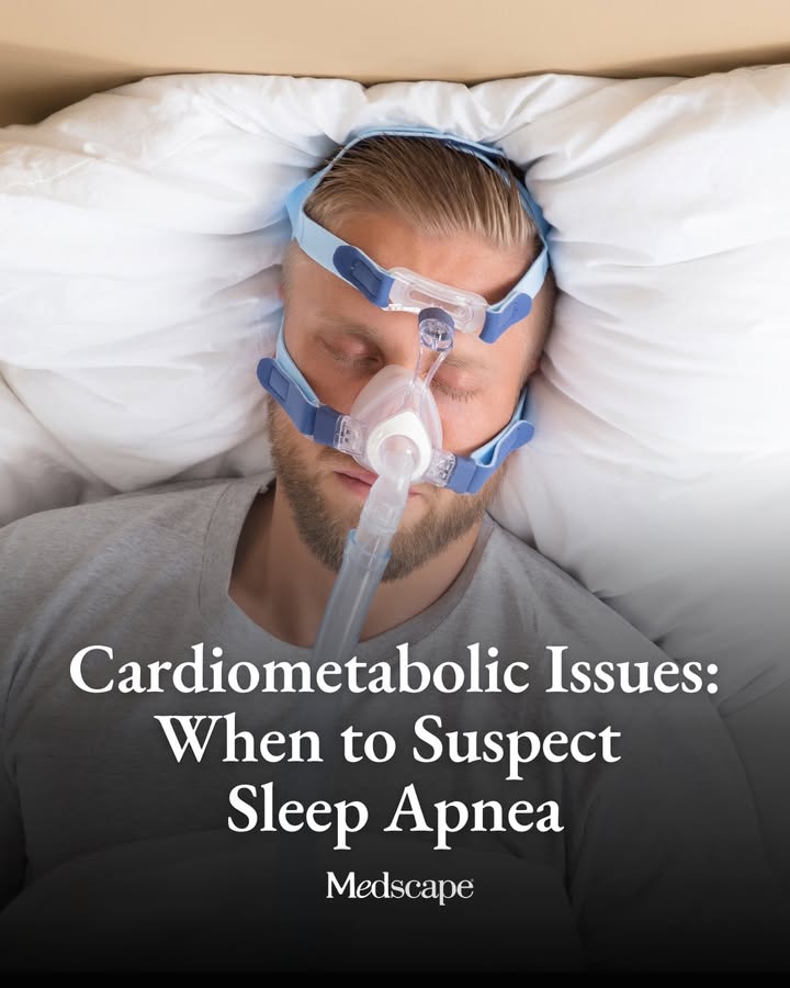 Medscape's tweet photo. For many patients with resistant hypertension, recurrent atrial fibrillation, type 2 diabetes, heart failure, or chronic kidney disease, clinicians often respond by escalating medications, adjusting treatment targets, or adding specialists. One contributor to persistent cardiometabolic disease that clinicians may overlook is obstructive sleep apnea (OSA).

The diagnostic challenge is that many patients with OSA do not present with the classic symptoms clinicians often associate with the disorder — snoring and excessive daytime sleepiness. Instead, they may show up with difficult-to-control blood pressure, nighttime symptoms, fragmented sleep, or worsening cardiovascular disease.

“Many of these patients are not sleepy,” said Sogol Javaheri, MD, associate physician in the Division of Sleep and Circadian Rhythm Disorders at Brigham and Women’s Hospital in Boston. For patients with high blood pressure, nocturia, or disrupted sleep, “doing a home sleep test is a great next step,” she said. https://t.co/LIdtaH17CH