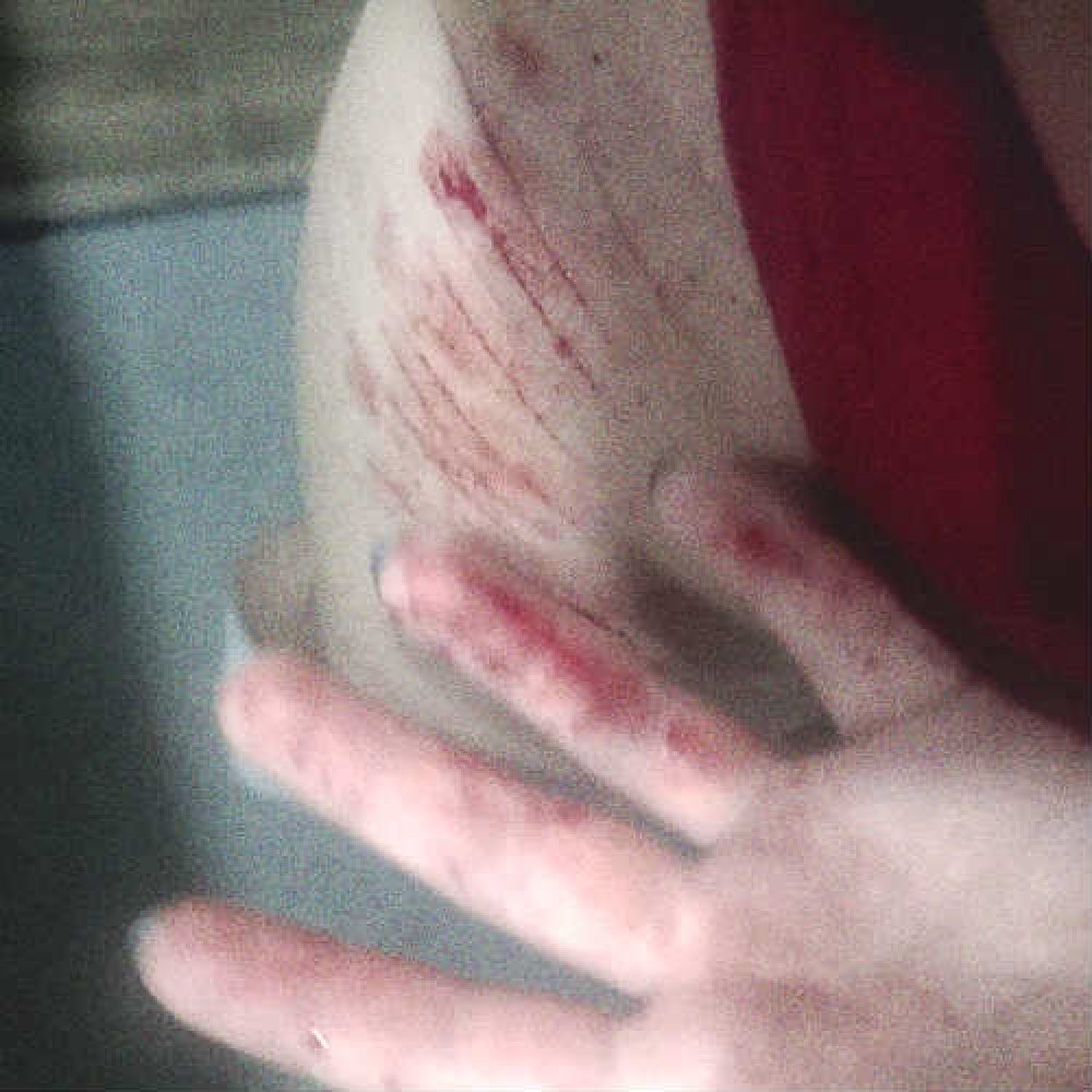 Azure0077's tweet photo. #sh #shtwt #selfharm https://t.co/lpw1a4YEii