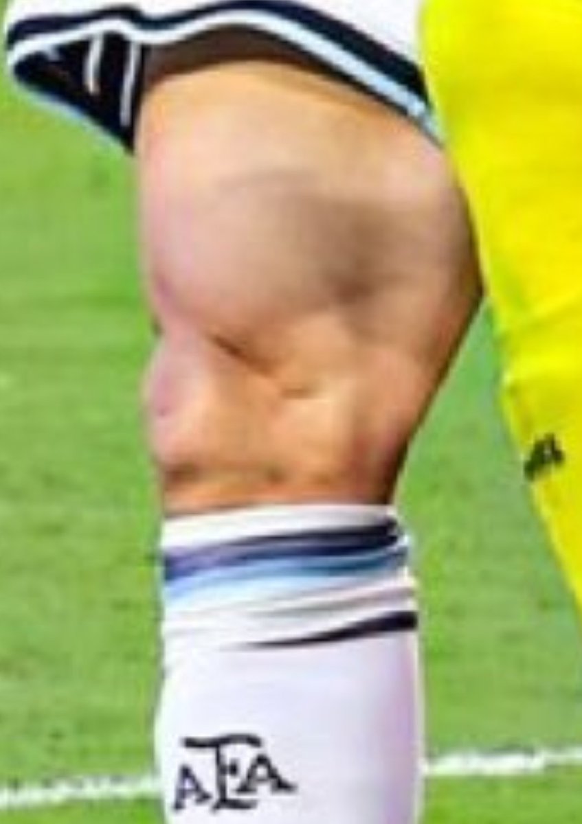 KetzR86's tweet photo. @ammandev Messi knee is battered...also looks like a face 🤯 not sure how many ops he had on that knee but bloody hell 😲 https://t.co/2kWsqWkpxI