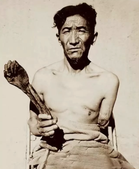 Allya10X's tweet photo. This is Tsering. That’s his own severed arm, shot off by his master, then dried and kept.

No longer useful, he was forced to beg.

This was life for over 95% of Tibetans before 1959. 🌿 https://t.co/L40escPbue