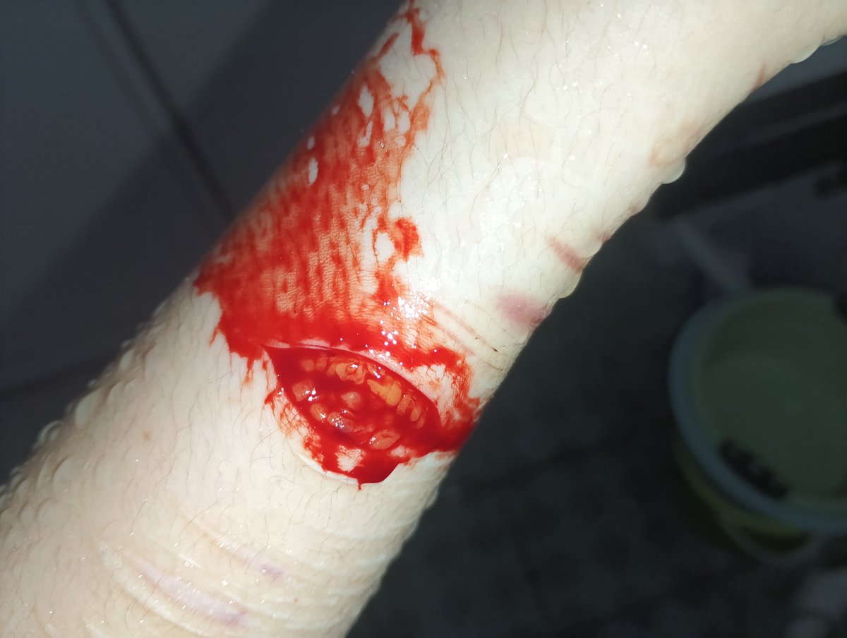Zolpidemod's tweet photo. 🔪🩸Today https://t.co/FtaYJnAYSq