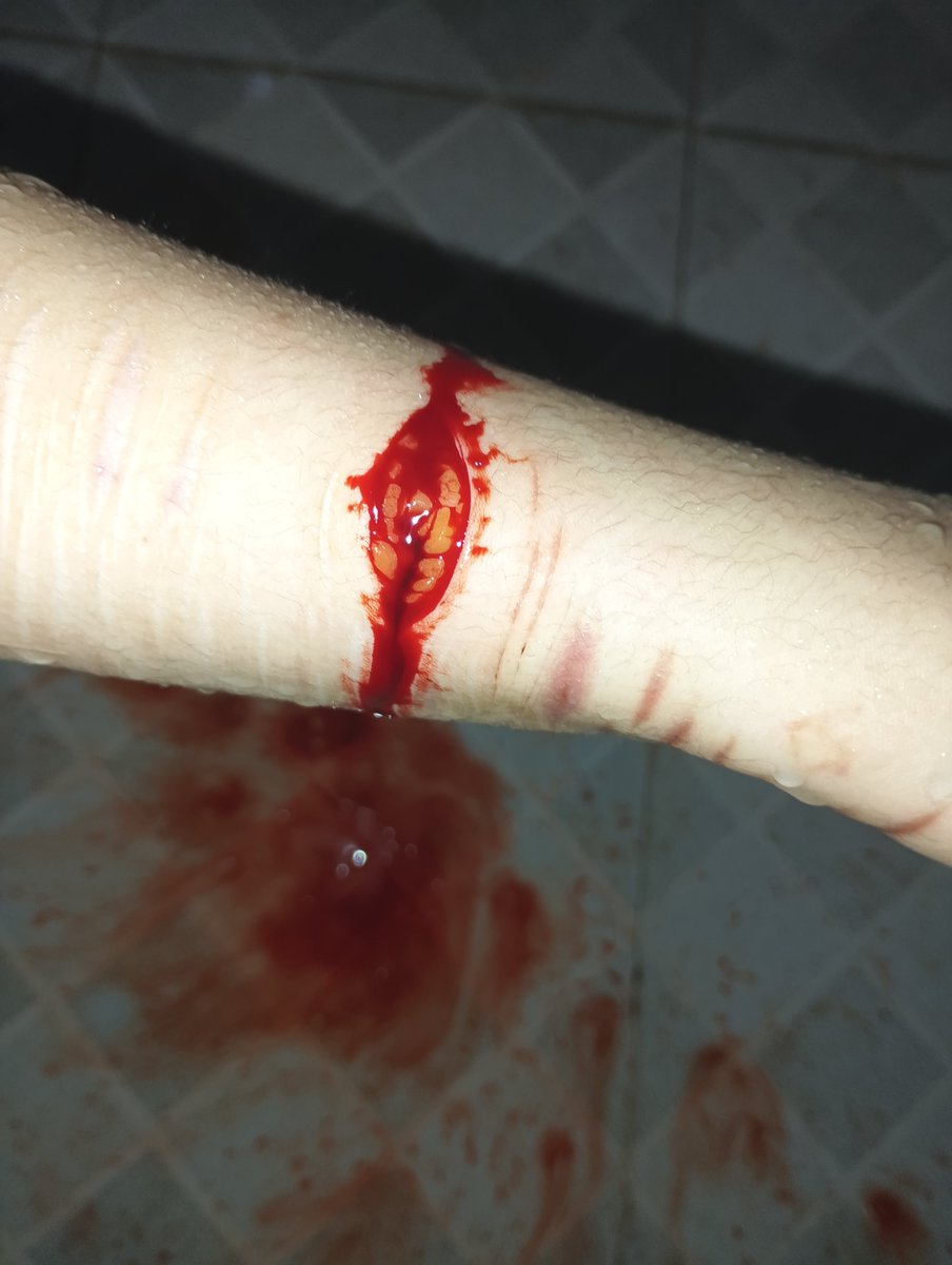 Zolpidemod's tweet photo. 🔪🩸Today https://t.co/FtaYJnAYSq