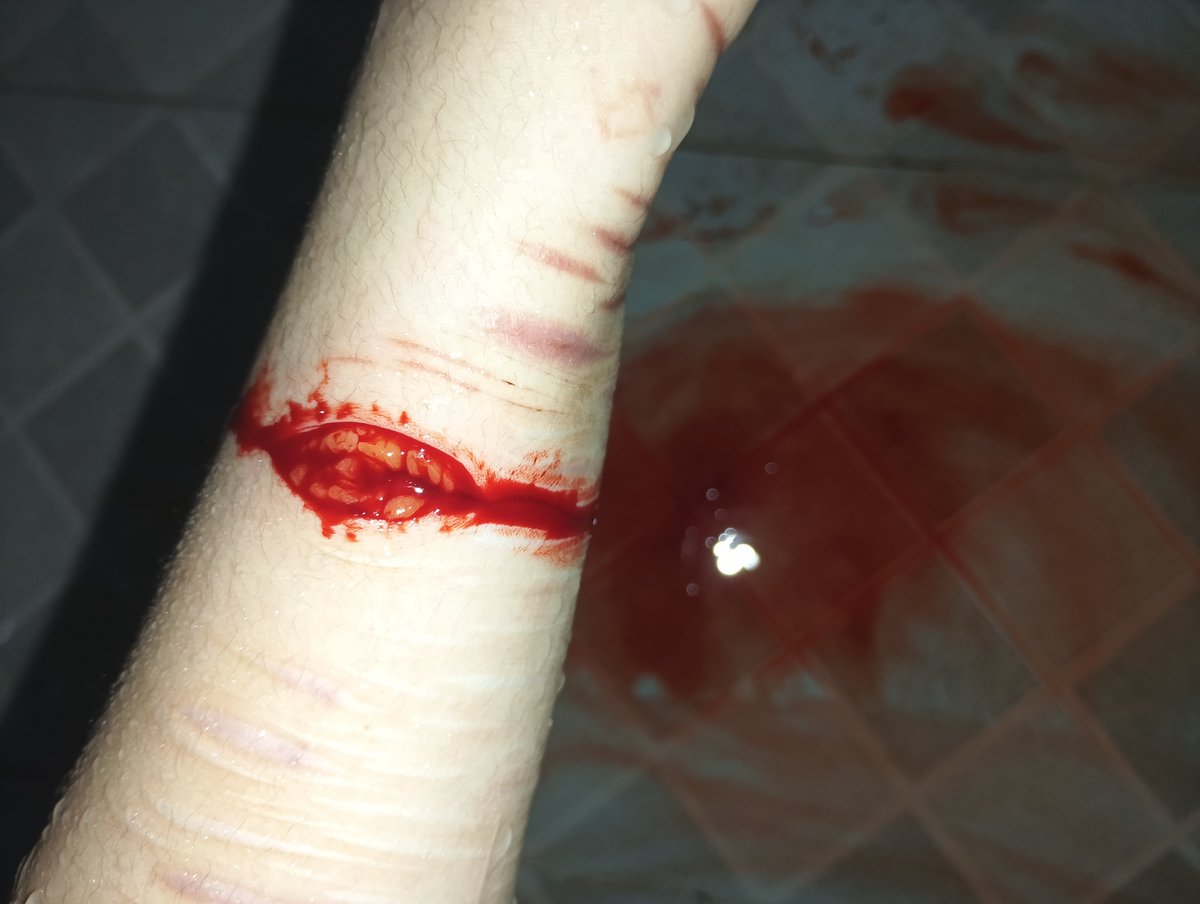 Zolpidemod's tweet photo. 🔪🩸Today https://t.co/FtaYJnAYSq
