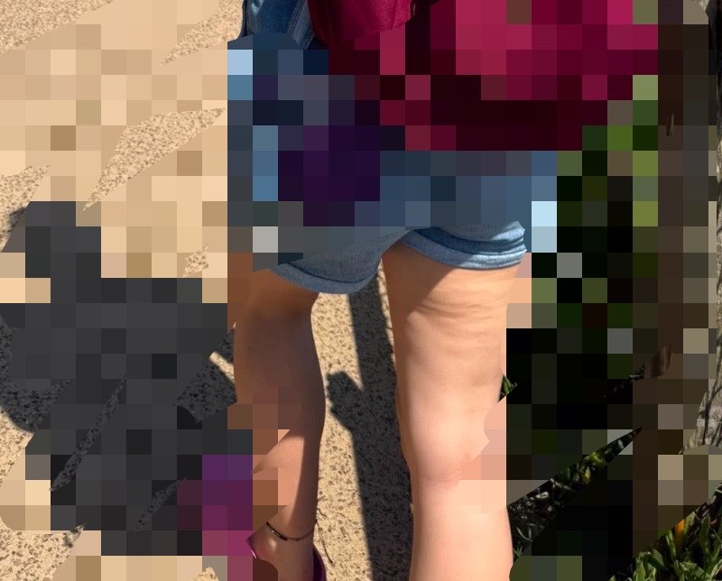 762angel3's tweet photo. MY CELLULITE OMG YOURE JOKING someone just sent me this photo im going to cry im so fat my thighs are so huge wtf https://t.co/vPwzr0Zd3b
