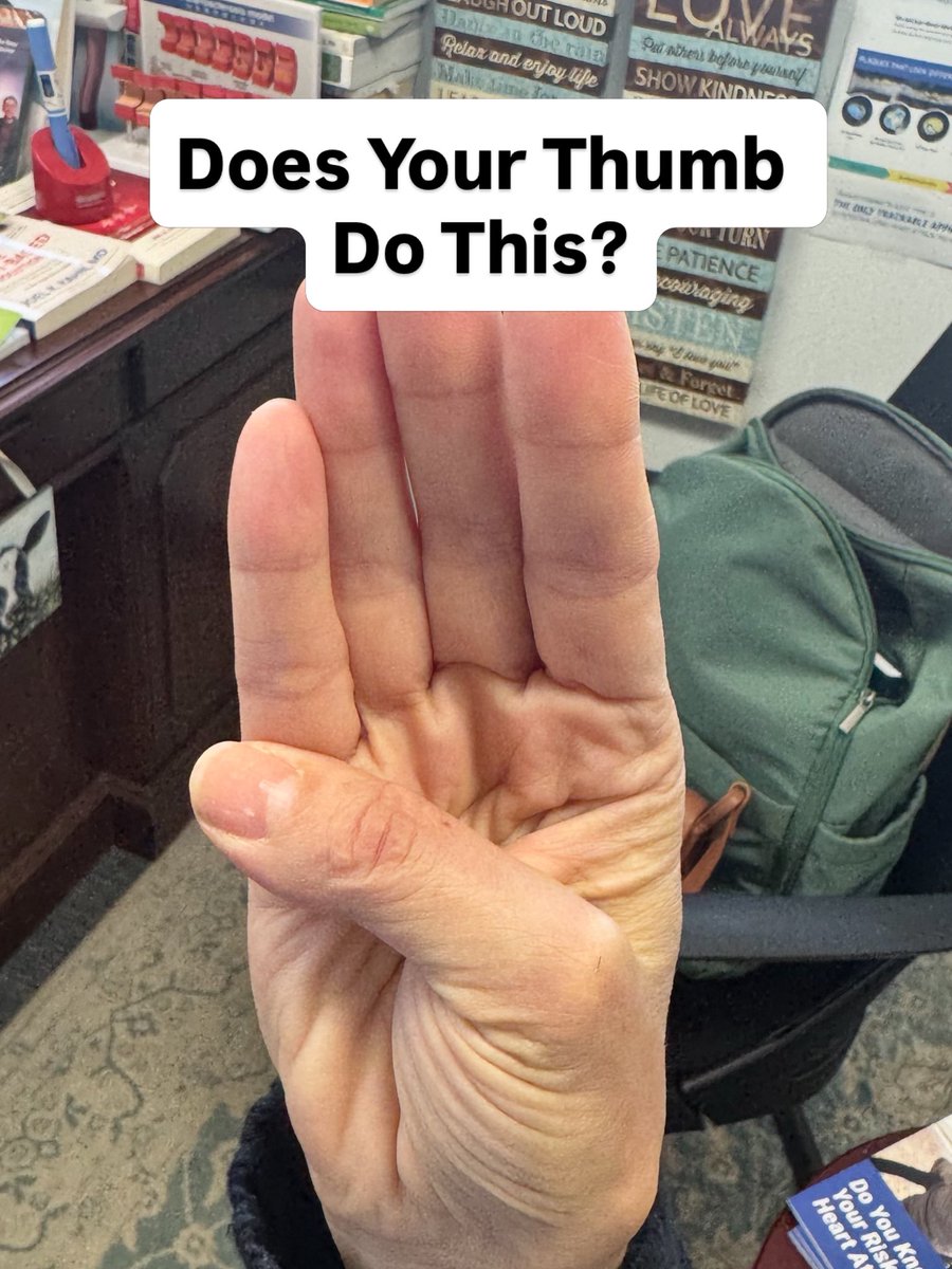 drjkahn's tweet photo. My patient is hyperflexible due to a condition called Ehlers-Danlos Syndrome.  Let’s her thumb go way past the edge of her hand. It can predict an enlarged aorta (aneurysm.  Does yours do this?  Ehlers-Danlos syndrome (EDS) is a group of 13 inherited connective tissue disorders caused by genetic variants affecting collagen and related proteins. These weaken tissues that support skin, joints, blood vessels, organs, and other structures.