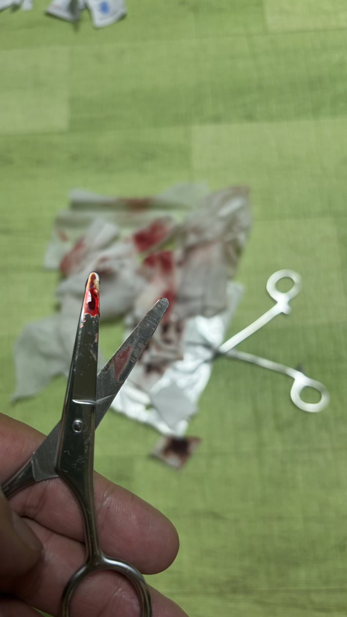 ad2k0001's tweet photo. 밤새 피가 멈���지 않아 힘들었다...
#subincision https://t.co/oUsGnEKdia