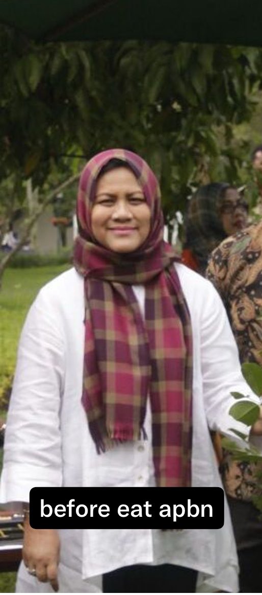NyaiNeneng's tweet photo. Hj. Iriana S.E M.M

Before eat apbn vs after eat apbn https://t.co/zVfhAmecdG