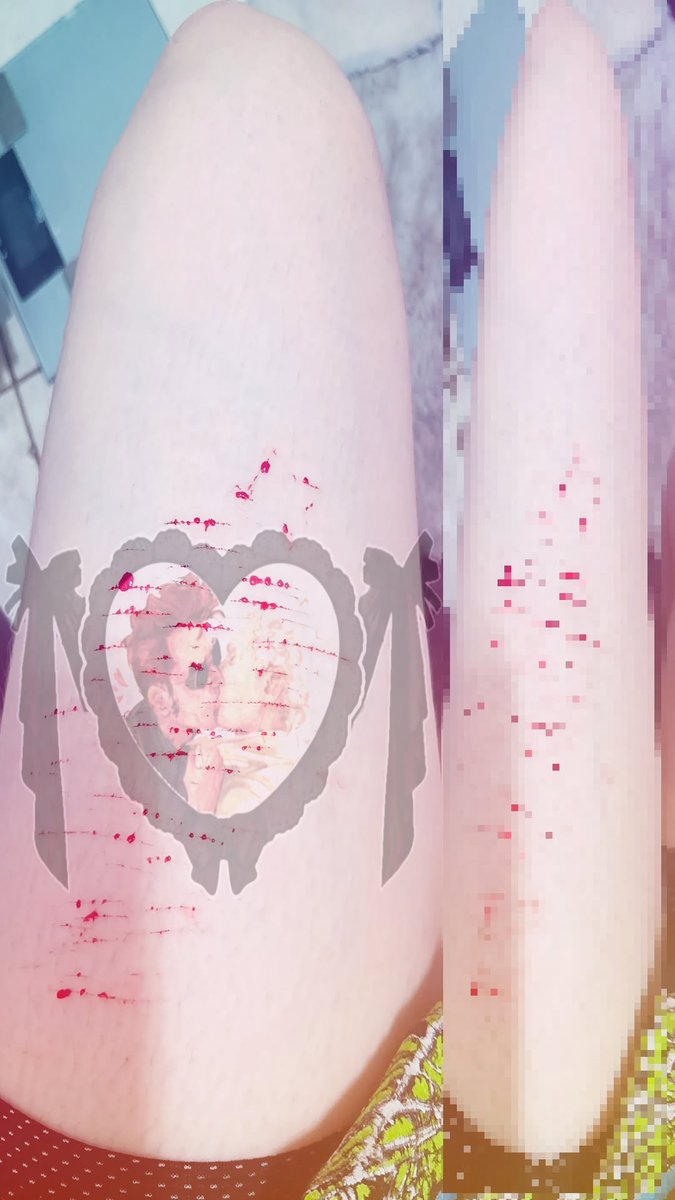 DuskandD4wn's tweet photo. ׄ ݊ ݂⠀Cuts ♥️  ◞  With + Without the gays #Shtwt #Owchie #Shedtwt #Cuts #كاس_العالم_٢٠٢٦ https://t.co/oweHZ6TVeL