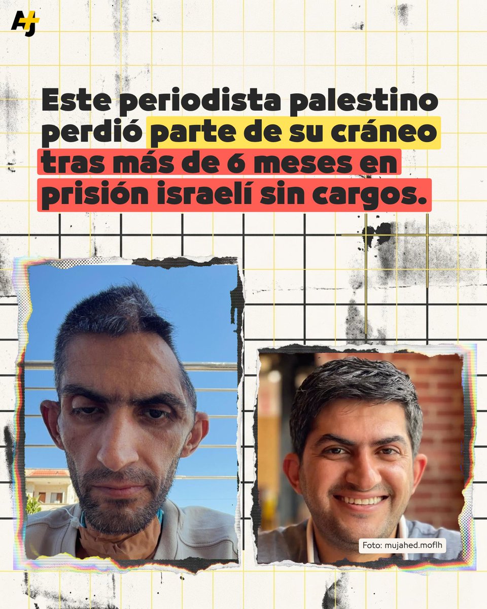 ajplusespanol's tweet photo. Este periodista palestino fue detenido por Israel en junio de 2025. Compartió estas fotos de su estado tras ser liberado. https://t.co/NJS3X5Knzg
