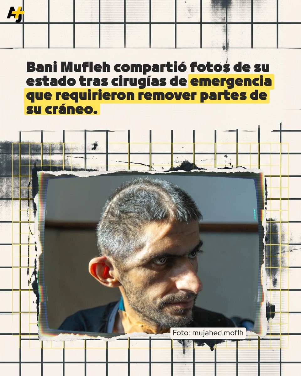ajplusespanol's tweet photo. Este periodista palestino fue detenido por Israel en junio de 2025. Compartió estas fotos de su estado tras ser liberado. https://t.co/NJS3X5Knzg