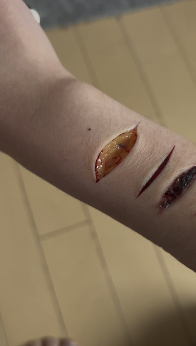 kyou_0207's tweet photo. 過去の
 #リスカ #アムカ #selfharm https://t.co/kWuNtBdjLd