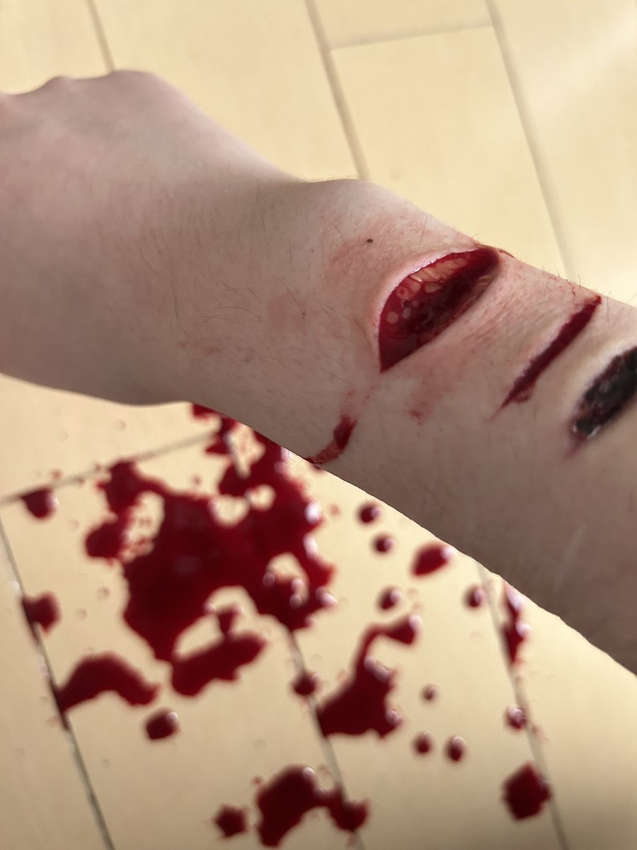 kyou_0207's tweet photo. 過去の
 #リスカ #アムカ #selfharm https://t.co/kWuNtBdjLd