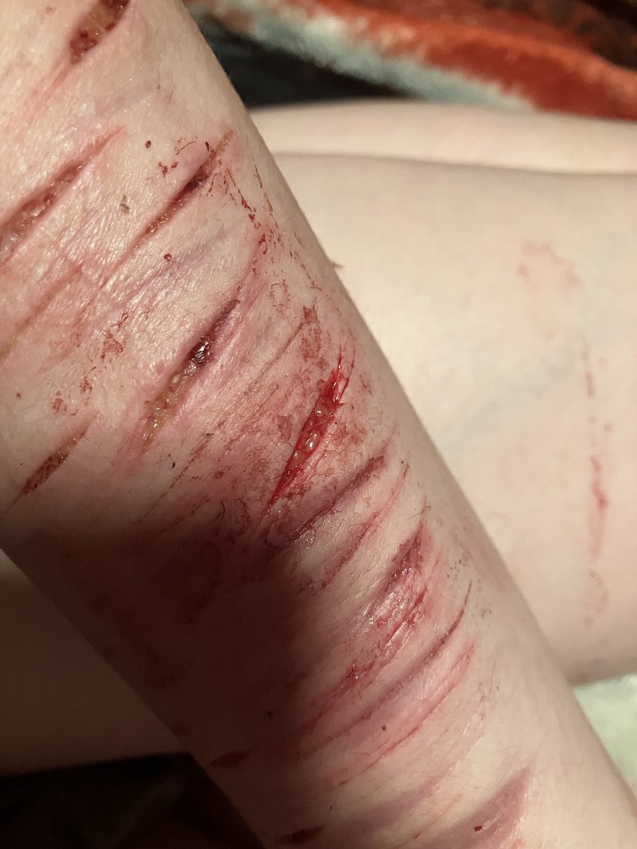 CheesyTartz's tweet photo. this feels so good ii swear. #slittwt #selfharm #shtwt #sledtwt #shedtwt #beanstwt #beans (Post is ai generated and heavily edited uhhhh makeup sfx, elon don’t murder me..) https://t.co/o9OXQbCkpm