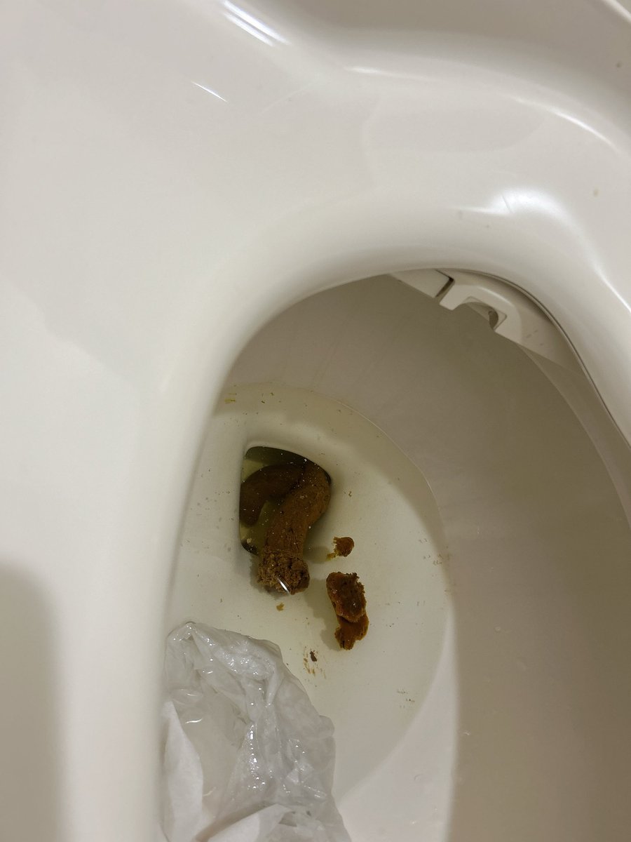 1___414's tweet photo. 昨日あんな感じで10回くらいはトイレ行ったし、お腹痛くて全然ご飯食べてなかったのに今日こんなに出た、、、、、 https://t.co/CBB8emzOHF