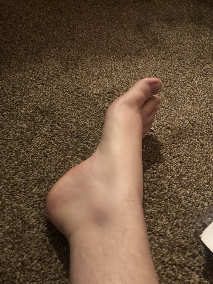 Plumbum0333's tweet photo. https://t.co/ohlfvN7qqQ
Way better feet pics on my site✨✨
#feet #footfetısh #feetworshi̇p #feetpics #toes #onlyfans
💖I’m doing free customs for my favourite subscribers💖 https://t.co/aa6br187W4
