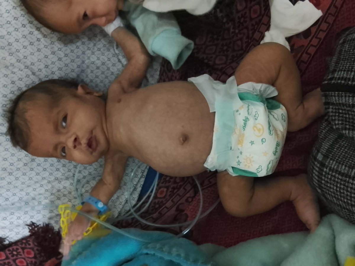 hamza460760's tweet photo. 🚨 Save Baby Malek

Malek is a 3-month-old baby from Gaza suffering from hydrocephalus. He urgently needs life-saving surgery and treatment outside Gaza.

We’re raising $15,000 to save his life.

❤️ Please donate or share.
#SaveMalek #Gaza #Donate
https://t.co/ZCxQrwYNGq https://t.co/dYF89ckMm1