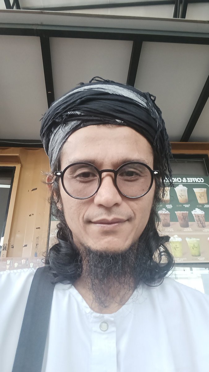 farockmayat's tweet photo. @lANZAlNAL @chilrenjag Misai yg botak. Rambut blum lg https://t.co/rcK9Q0Au4f