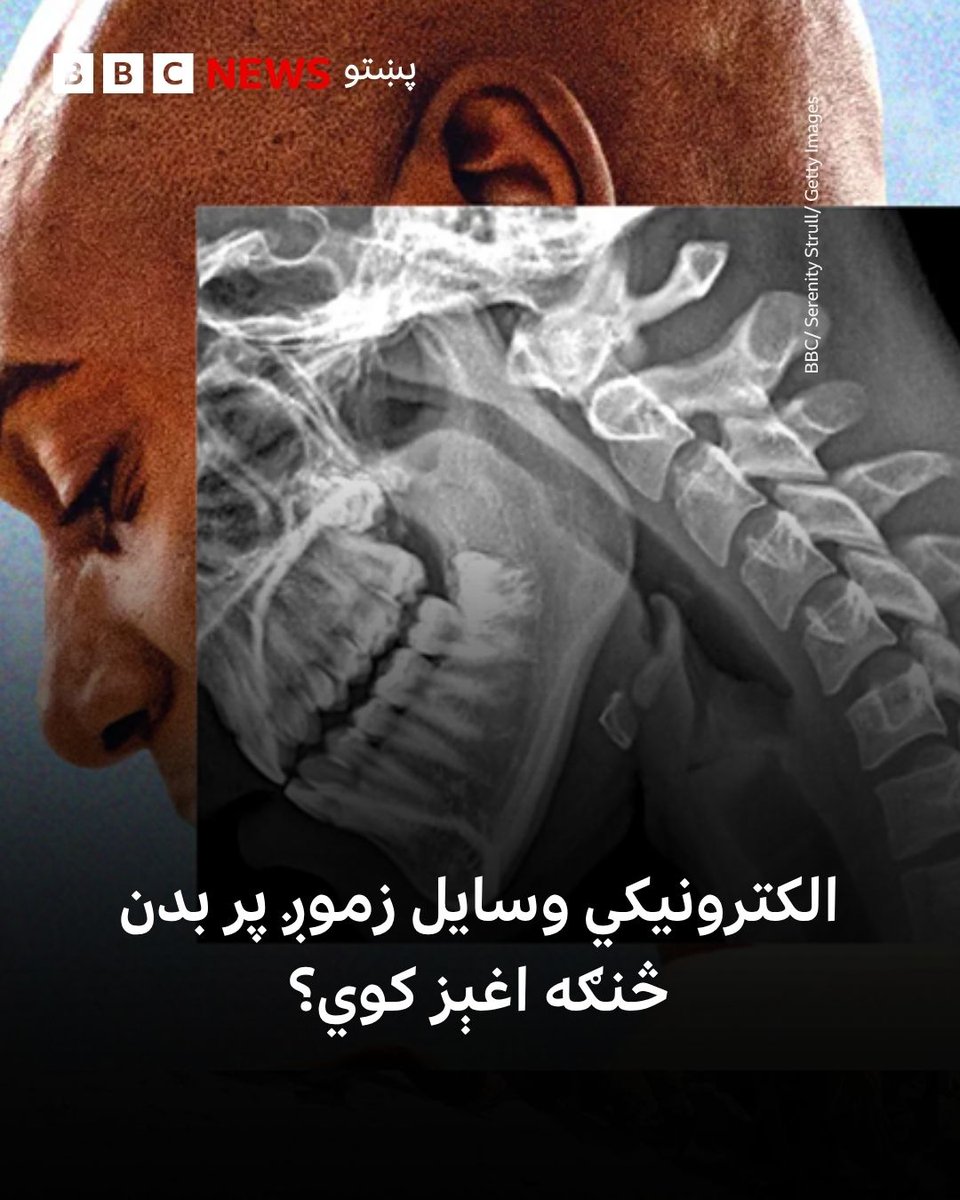 bbcpashto's tweet photo. الکترونیکي وسایل ستاسو پر بدن داسې اغېزې کوي چې ښايي تاسو یې احساس هم نه کړئ، خو بیا هم کولی شئ د دې اغېزو د کمولو لپاره ګامونه واخلئ. 

جزییات یې پر بي بي سي پښتو ټکی کام لوستلی شئ
https://t.co/6O8rzT4Bdd https://t.co/0W4jos13KH