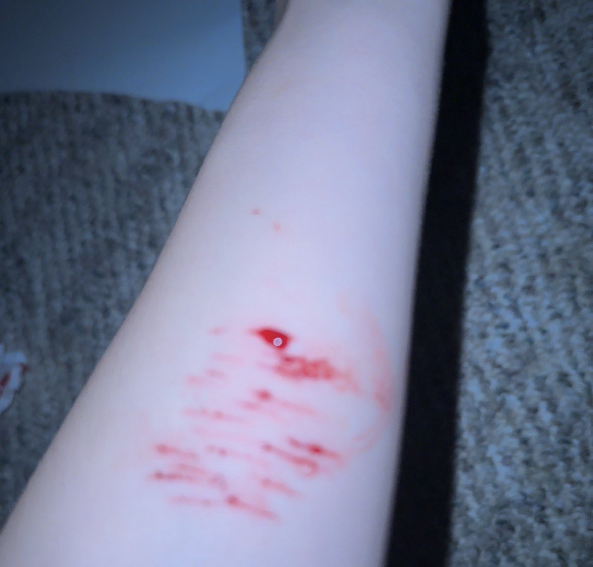 Kameronit's tweet photo. pathetic cat scratches so my family doesn’t worry #shtwt #shedtwt ill go deeper sometime else https://t.co/fQXgteXvB8