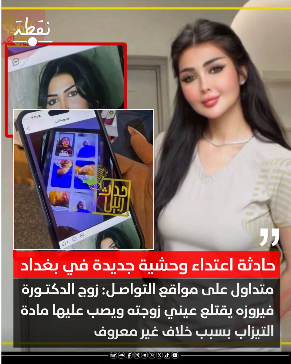 noqtaiq's tweet photo. 🔴 حادثة اعتداء وحشية جديدة في بغداد

📌 متداول على مواقع التواصل: زوج الدكتورة فيروزه يقتلع عيني زوجته ويصب عليها مادة التيزاب بسبب خلاف غير معروف

📌 الدكتورة فيروزه أصيبت إصابات خطيرة وحالتها بين الحياة والموت

#نقطة https://t.co/nThRroTEKd