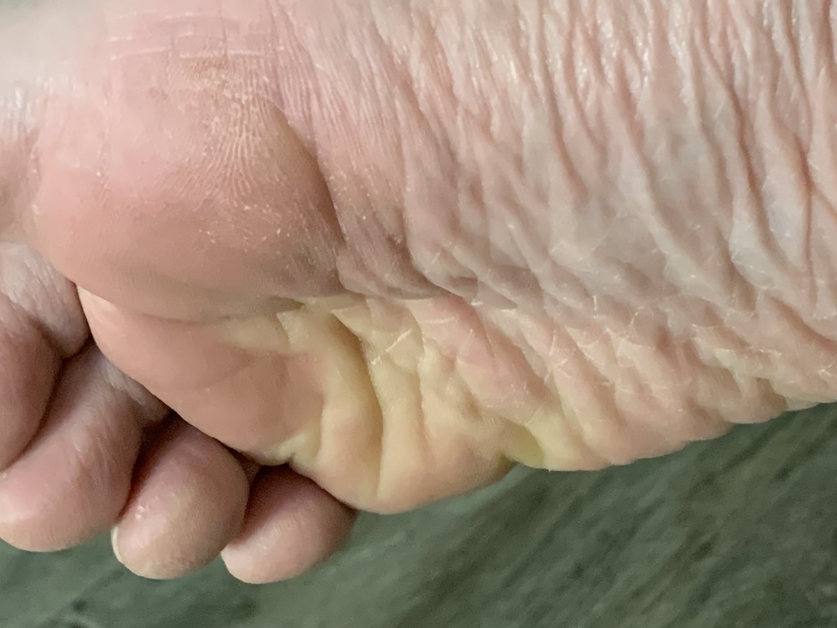 TryFootly's tweet photo. Wrinkled sole close-up doing exactly what the timeline came for 😮‍💨🦶

Tease stays public. Full set stays private and verified. https://t.co/fFVVwT6RM5