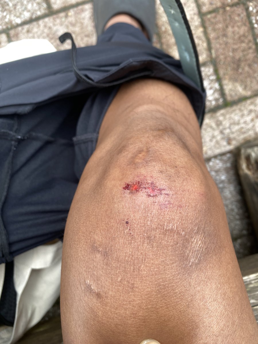 blekdutt's tweet photo. hari ini selesai!.
gatau kenapa data strava sama coros beda waktunya. tapu aku percaya dengan data coros dan data di sertifikat. waktu race ada kejadian yang mau gamau diri ini menabrakan diri ke pohon, kalau tidak aku udah gabisa ngetweet tweet ini (alias jatuh ke jurang). https://t.co/SDCnENfoIr