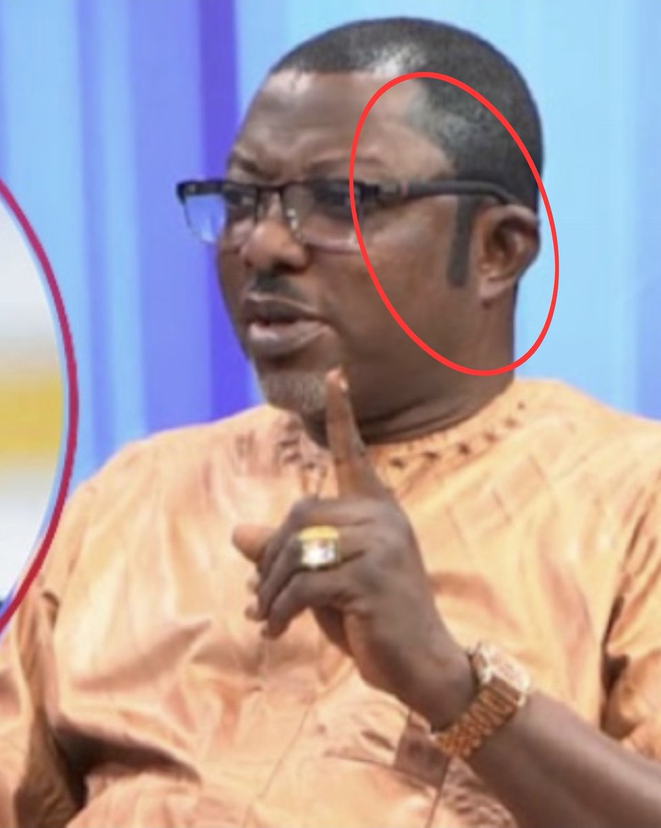 Oserume1's tweet photo. @ARISEtv Obviously, the cheap dye is affecting Abayomi's brain cells! https://t.co/XW0m3JqDuK