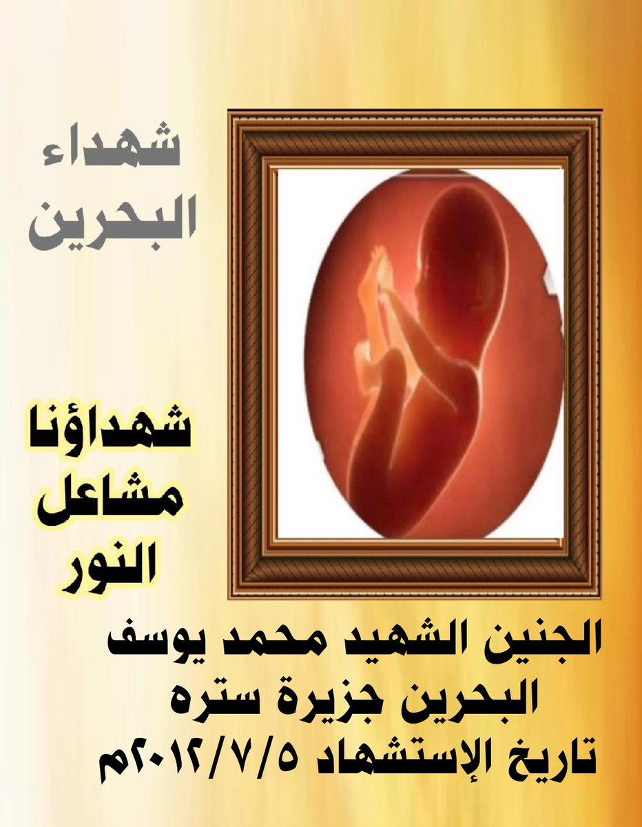 qaherathalmain's tweet photo. اليوم ذكرى إستشهاد الجنين 
#الشهيد_محمد_يوسف 
#البحرين جزيرة #سترة #سفالة 
تاريخ الإستشهاد ٢٠١٢/٧/٥
 استشهد بعد استهداف عصا بـة آل خليفة منزلهم والأحياء السكنية والمتظاهرين بالغازات السامة بعد استنشاق والدته للغازات السامة وهي حامل به وتسمم جسده فقضي مع أخيه 
#شهداؤنا_مشاعل_النور https://t.co/1juIUHfx2S