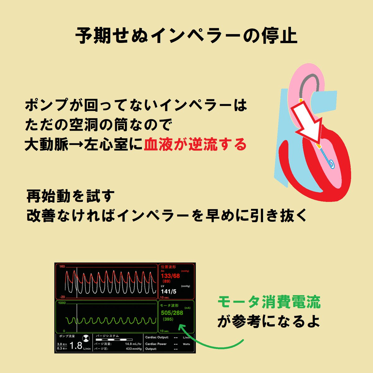 ce7meliteracy's tweet photo. 「インペラーの管理」をまとめたよ！👏👏

どこを見とけばいいんだっけ？😳

これでレべチ間違いナシ🤝 https://t.co/iUlZ0d4qr9