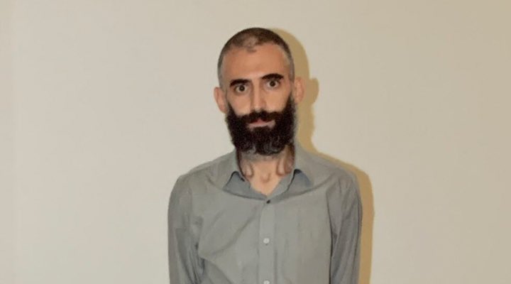 KOMUN__80's tweet photo. Kuyu Tipi Hapishaneler; başta devrimciler olmak üzere, muhalif seslere ve halka yönelik bir saldırıdır.

Bu saldırıya 266 gün açlık greviyle direnen ve yaklaşık üç aydır yoğun bakımda tedavi gören devrimci tutsak Gürkan Türkoğlu ölümsüzdür.

Kuyu Tipi Hapishaneler Kapatılsın! https://t.co/7ipOZZ4jv3