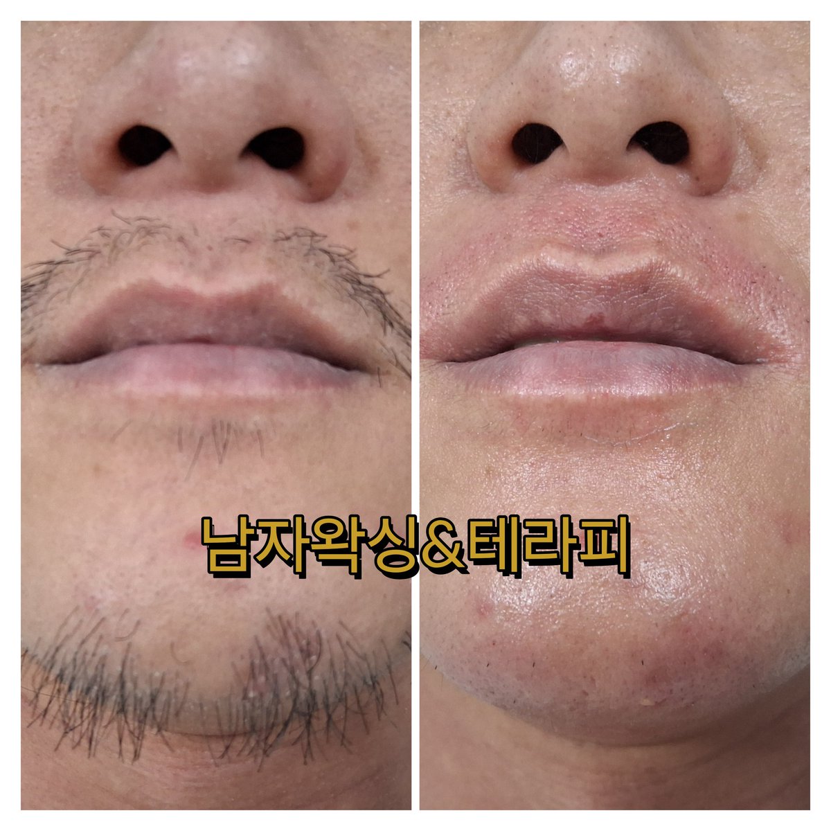 MannerBeauty_'s tweet photo. 힘들고 지친 나에게
보상이 필요하다면!

이제 나를 아껴주고
사랑해주고 싶다면!

깔끔한 외모로
신뢰감을 주고싶다면!

왁싱 가격은 사진 확인해주시고,
오일테라피는 이벤트 기간동안
60분 4만원
80분 6만원
100분 8만원
🎉🎉🎉🎉🎉

#남자왁싱 #남자왁서 #부산왁싱 #전신테라피 #대연동왁싱 https://t.co/WMbptuYZMx