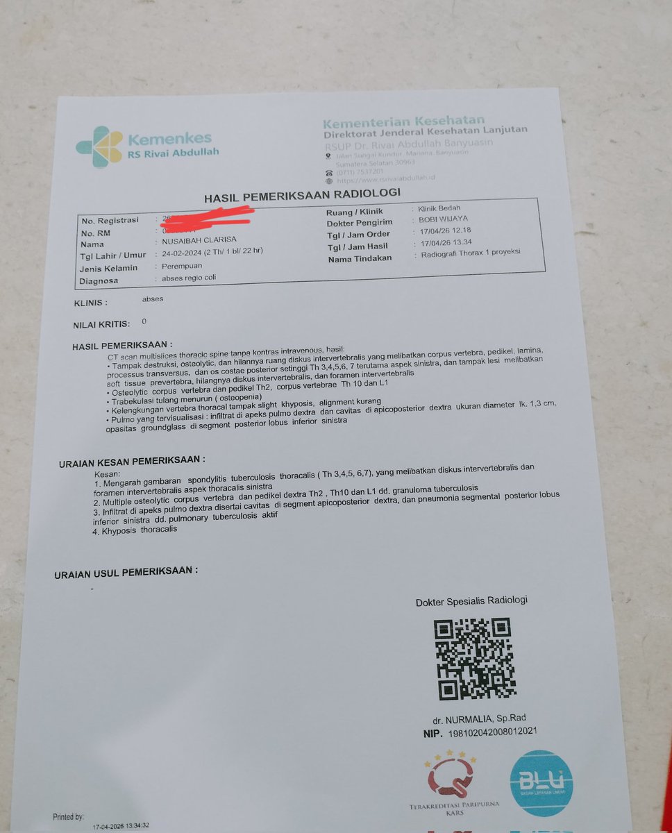 clarisanusa's tweet photo. Dan aku baru sadar setelah merhatiin cara nya berdiri dan berjalan.

Ternyata perjalanannya masih panjang nak 🥹
Ibuk kira sampe 6 bulan fisio udah kelar 
Tapi ternyata masih harus ke orthopedi

TB kelenjar dan Khyposis thoracalis https://t.co/EISW4awIpk