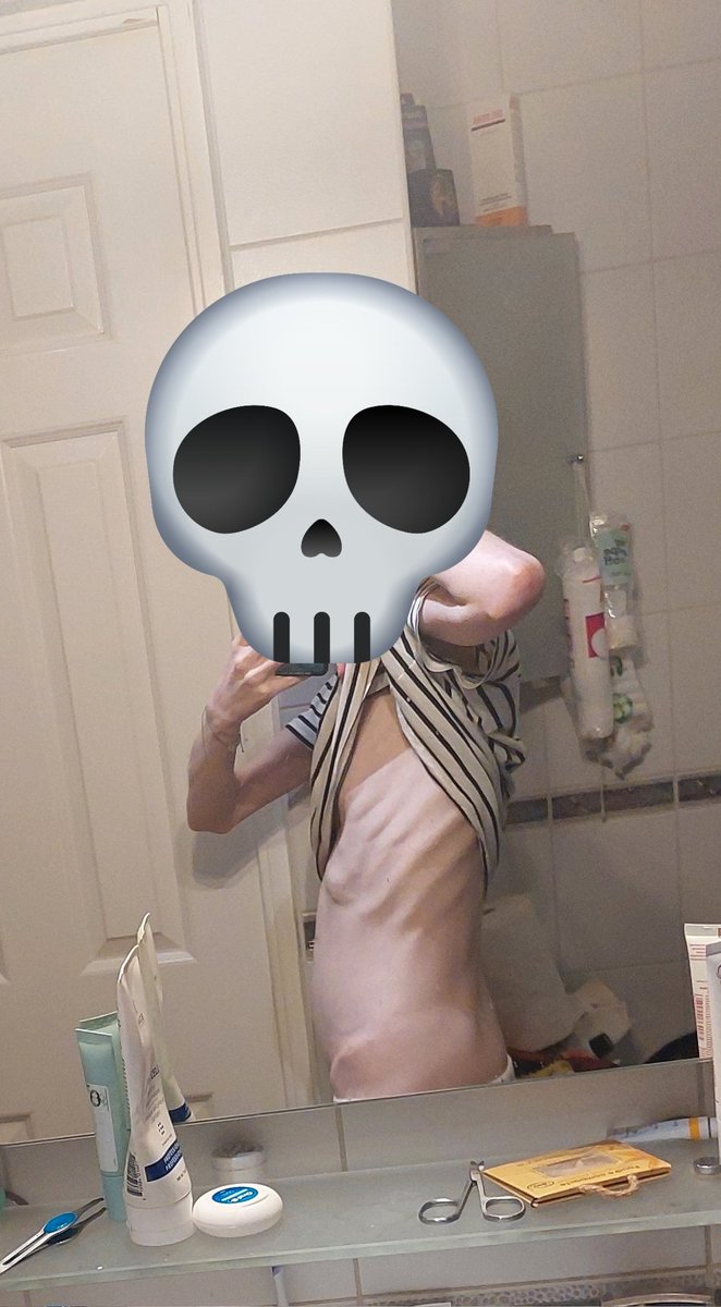 LEXETIV01's tweet photo. Before and after😕 still fat af. https://t.co/mVMeSJCjan