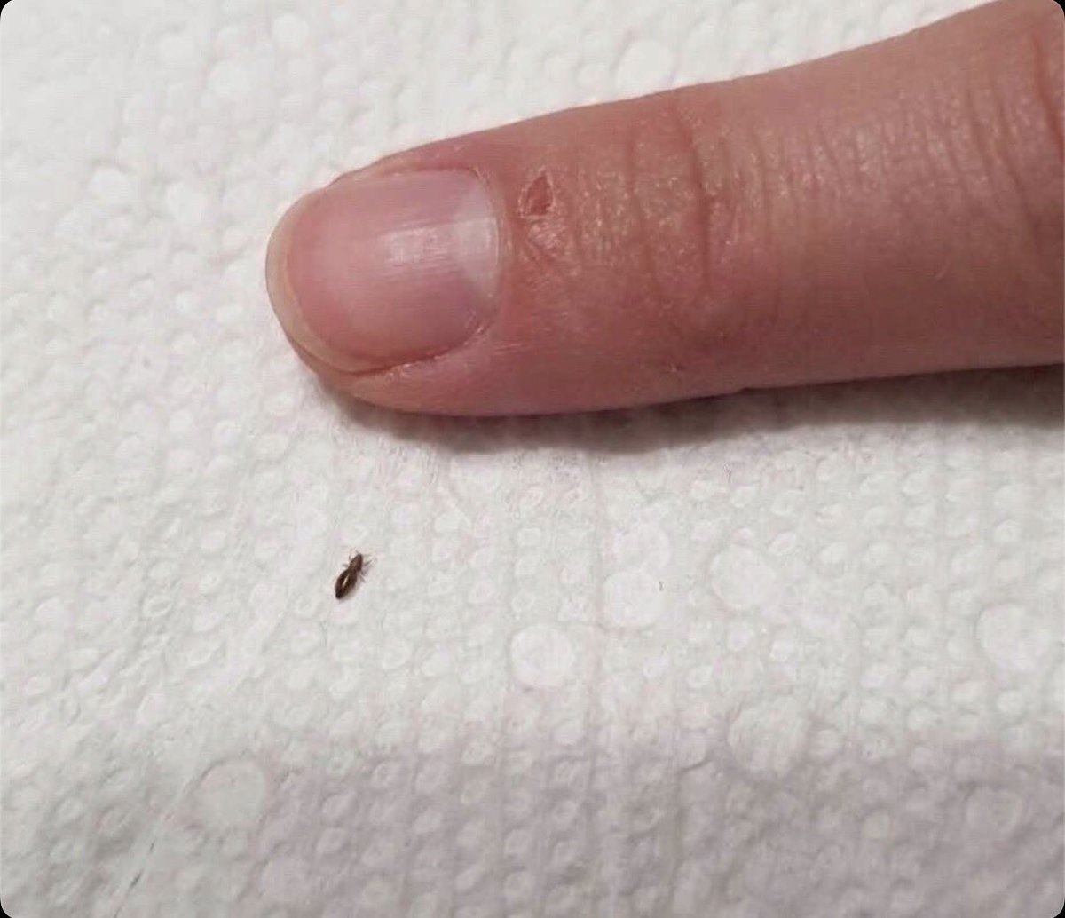 keertenkelee's tweet photo. Tatilden dönüşte saçım çok kaşınıyordu. Sonra taraken bu tarağıma geldi. Endişelenmelimiyim nedir bu..? https://t.co/LnbPqdv1ZJ