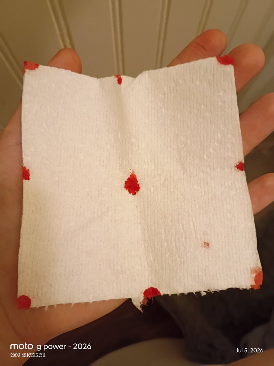aceypieee's tweet photo. Tad bit.if blood art from a bug bite
I CAN'T WAIT TO FINALLY CUT LATERRRRR
#shtwt https://t.co/Rw5SGpaNSw
