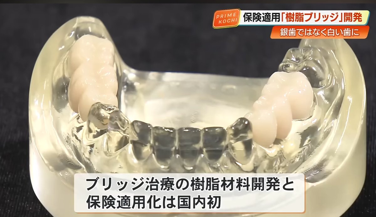 4ki4's tweet photo. 銀歯から白い歯へ「YAMAKIN」国内初開発の《樹脂ブリッジ》が保険適用、治療費は3割減 - YouTube
https://t.co/ADNYlEj10h https://t.co/l6Fz3PA4cg
