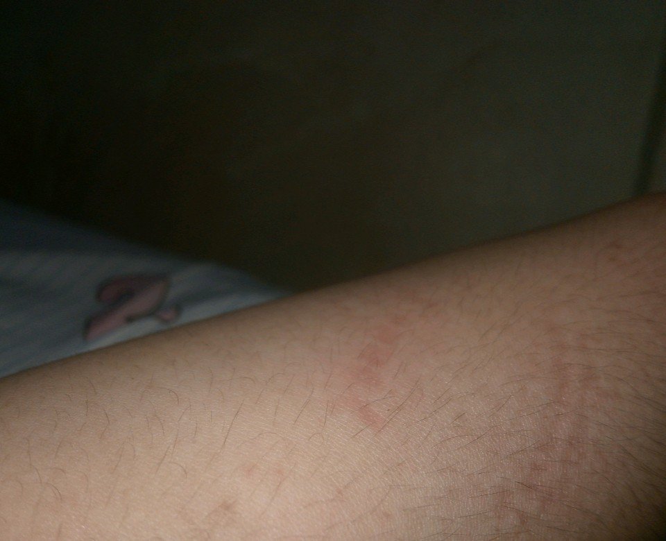 wwwellahcom's tweet photo. 'di kinaya awatin ng lagnat yung pagfifinger e😮‍💨 

(kinagat ko na forearm ko para walang ingay😭) https://t.co/RbFnf6kIjt