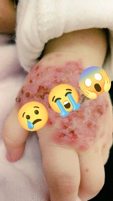 yousefQasem1998's tweet photo. I BEG YOU😭

Stop please😭

My child is dying😭

Don't ignore

beg you

 Help me

I need Diapers

beg you

Help me

I need MILK 

I need MILK

I need MILK

I need MILK

BEG YOU 

I need MILK

I need MILK

I need MILK

I need MILK

I need MILK

Help me😭

https://t.co/45Gj0rpJam https://t.co/7CwRiuK9dW