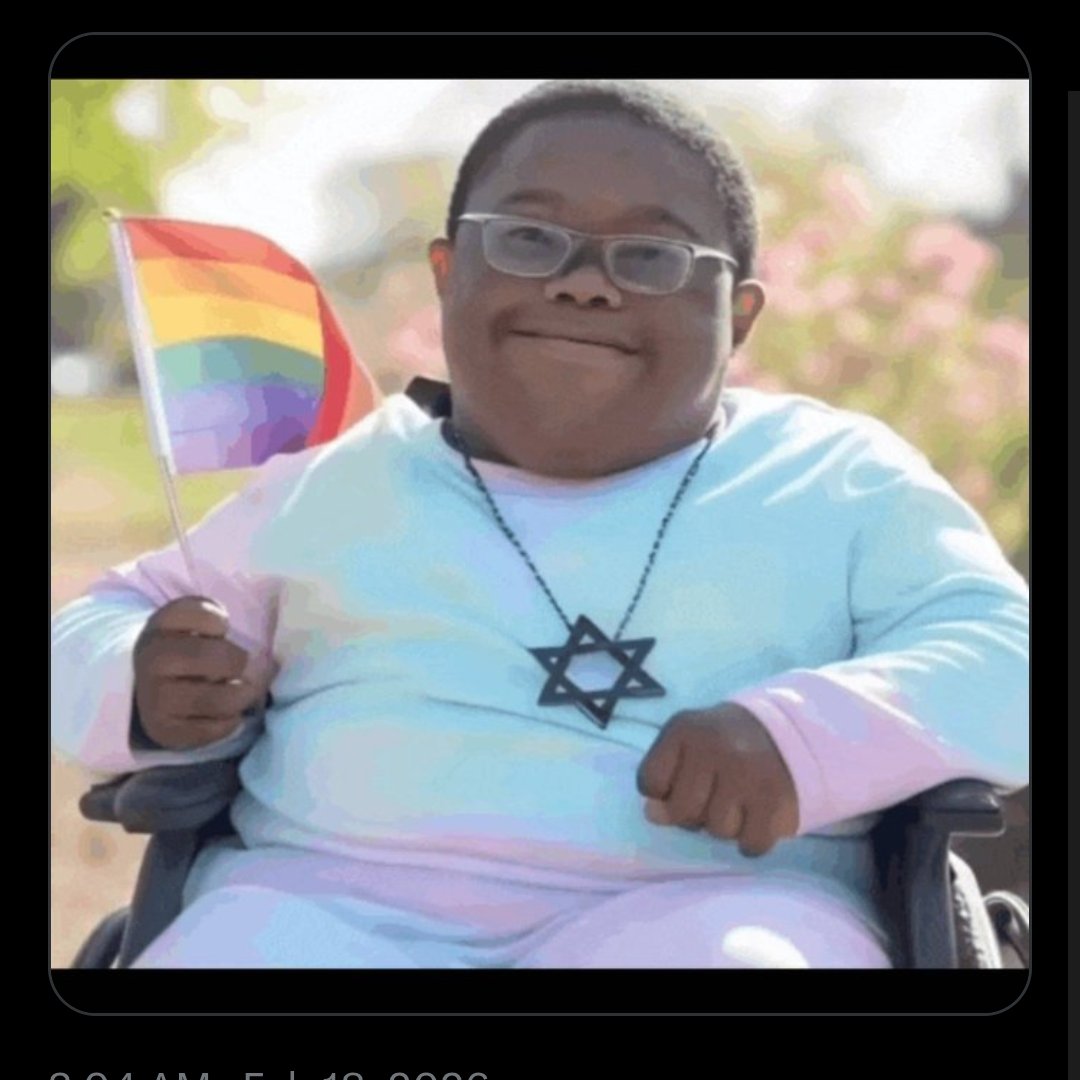 SoberGeorgtal's tweet photo. @ohitzty @Scamp0619 @InternetReels Jews arent white silly nigger.  Niggers are essentially jews thats why they worship them. Dumb ass slave nigger lmao https://t.co/T6tfX3m9gC