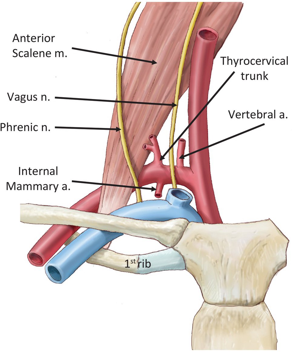 PipeCabreraV's tweet photo. 1st part of the subclavian artery! Anatomy and surgical approaches cornerstones! @SWexner @pferrada1 https://t.co/9jiOo4JNki