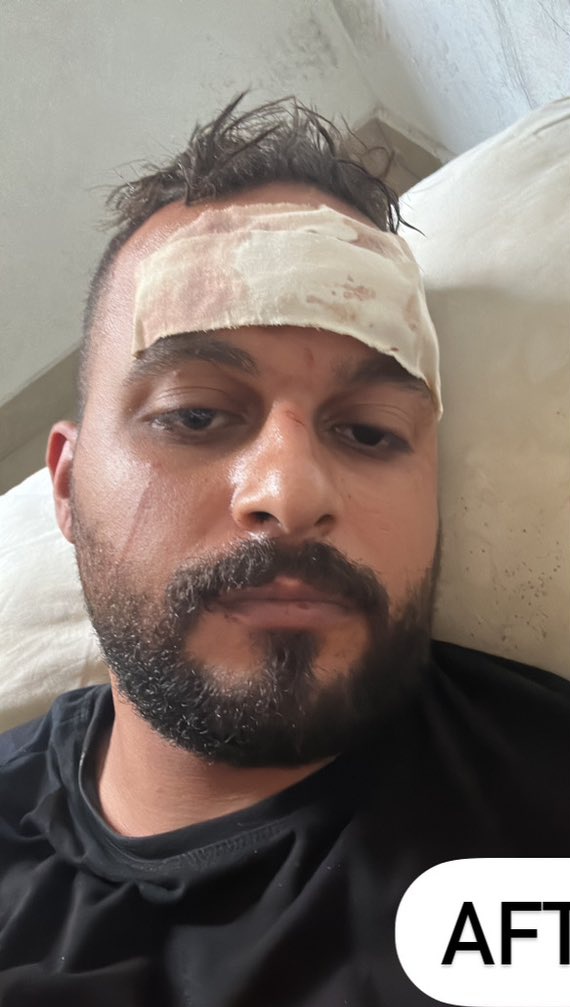 sistertonin's tweet photo. good morning.

thank you for all the support given.

can anybody keep the support going?

arafah has to care for 6 people including his mother and a child.

he has no access to work equipment or basic necessities like food.

it's very difficult right now.

https://t.co/aoxCCu75Ow https://t.co/QznSR3xYJ5