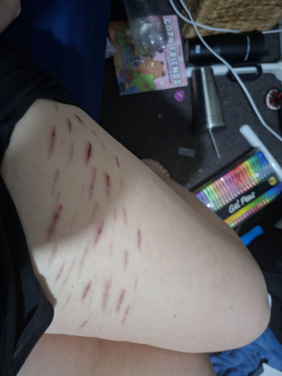 wifiesisback's tweet photo. Healing and scars https://t.co/3SEYNFphZq