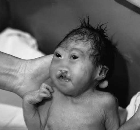 SankaraDispatch's tweet photo. The USA did this to children in Vietnam — with Agent Orange. https://t.co/MlhSyVHWRx