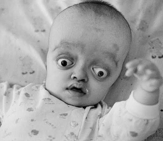 SankaraDispatch's tweet photo. The USA did this to children in Vietnam — with Agent Orange. https://t.co/MlhSyVHWRx
