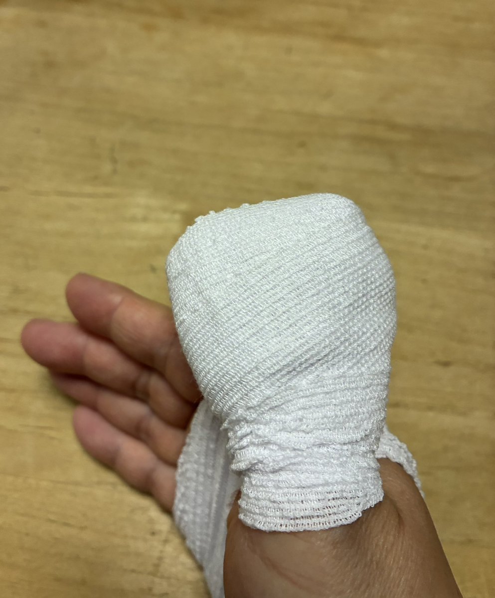 mochan5709's tweet photo. 夜9時半過ぎにネギを小口切りしてたら
右親指先の爪からザックリパックリ
包丁で切りまして血が止まらず
夜間救急病院へ。
なんとか血は止まったけど
ガーゼと包帯ぐるぐるにしてもらいました。
診てもらえてよかった〜 https://t.co/lRvG8CWLUA